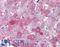 FACT complex subunit SPT16 antibody, LS-B1906, Lifespan Biosciences, Immunohistochemistry paraffin image 