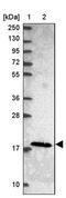 Mitochondrial Ribosomal Protein L21 antibody, PA5-62451, Invitrogen Antibodies, Western Blot image 