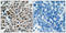 Forkhead Box O3 antibody, LS-C198963, Lifespan Biosciences, Immunohistochemistry paraffin image 