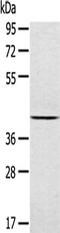 JNK1 + JNK2 antibody, CSB-PA208890, Cusabio, Western Blot image 