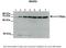 NADH:Ubiquinone Oxidoreductase Core Subunit S1 antibody, NBP1-56520, Novus Biologicals, Western Blot image 