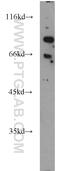 Forkhead Box P1 antibody, 22051-1-AP, Proteintech Group, Western Blot image 