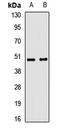 Tripartite Motif Containing 44 antibody, LS-C668776, Lifespan Biosciences, Western Blot image 