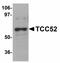 DDB1 And CUL4 Associated Factor 12 antibody, LS-C108702, Lifespan Biosciences, Western Blot image 