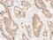 Carbonic Anhydrase 12 antibody, GTX02237, GeneTex, Immunohistochemistry paraffin image 