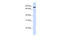 Mitogen-Activated Protein Kinase Kinase Kinase Kinase 2 antibody, ARP48632_P050, Aviva Systems Biology, Western Blot image 