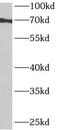 Ankyrin Repeat Domain 55 antibody, FNab00418, FineTest, Western Blot image 