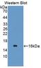 Tetraspanin 1 antibody, LS-C704359, Lifespan Biosciences, Western Blot image 