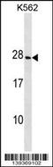 Crystallin Gamma D antibody, 60-145, ProSci, Western Blot image 