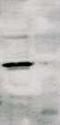 Transforming Growth Factor Beta Receptor 1 antibody, TA354906, Origene, Western Blot image 