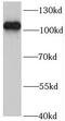 R3H Domain And Coiled-Coil Containing 1 Like antibody, FNab00998, FineTest, Western Blot image 