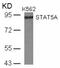 Signal Transducer And Activator Of Transcription 5A antibody, 79-290, ProSci, Western Blot image 