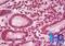 Cyclin D1 antibody, NBP2-24695, Novus Biologicals, Immunohistochemistry frozen image 