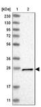 Metaxin 2 antibody, NBP1-87436, Novus Biologicals, Western Blot image 