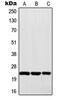 Mitotic Arrest Deficient 2 Like 1 antibody, MBS820663, MyBioSource, Western Blot image 