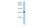 Electron Transfer Flavoprotein Subunit Alpha antibody, 26-842, ProSci, Enzyme Linked Immunosorbent Assay image 