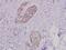 Phosphoinositide-3-Kinase Regulatory Subunit 1 antibody, A00318Y463, Boster Biological Technology, Immunohistochemistry paraffin image 