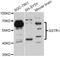 Somatostatin Receptor 1 antibody, abx126654, Abbexa, Western Blot image 