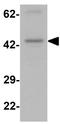 Proline Rich Transmembrane Protein 2 antibody, GTX32116, GeneTex, Western Blot image 
