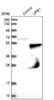 Beta-Ureidopropionase 1 antibody, NBP1-89918, Novus Biologicals, Western Blot image 