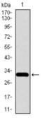 Solute Carrier Family 27 Member 5 antibody, abx015989, Abbexa, Western Blot image 