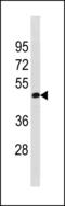 Transcription initiation factor TFIID subunit 7-like antibody, LS-C203842, Lifespan Biosciences, Western Blot image 