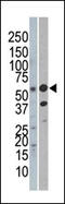 REL Proto-Oncogene, NF-KB Subunit antibody, 62-252, ProSci, Western Blot image 