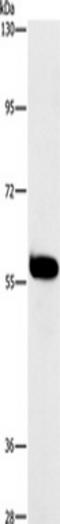 HCK Proto-Oncogene, Src Family Tyrosine Kinase antibody, TA349335, Origene, Western Blot image 