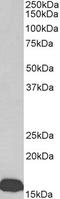 Prealbumin antibody, TA326301, Origene, Western Blot image 