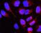 Lamin B Receptor antibody, A01238-2, Boster Biological Technology, Immunofluorescence image 