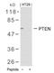Phosphatase And Tensin Homolog antibody, 79-296, ProSci, Western Blot image 