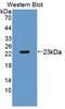 TIMP Metallopeptidase Inhibitor 2 antibody, LS-C304914, Lifespan Biosciences, Western Blot image 