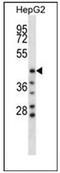 Hyaluronidase 1 antibody, AP52132PU-N, Origene, Western Blot image 