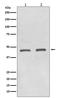 Histone Deacetylase 11 antibody, M06209, Boster Biological Technology, Western Blot image 