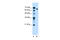 Nuclear Receptor Subfamily 5 Group A Member 2 antibody, 28-855, ProSci, Western Blot image 