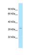 ADP Ribosylation Factor GTPase Activating Protein 3 antibody, orb331155, Biorbyt, Western Blot image 