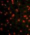 Cadherin 4 antibody, LS-B8990, Lifespan Biosciences, Immunofluorescence image 