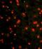 Cadherin 4 antibody, LS-B8990, Lifespan Biosciences, Immunofluorescence image 