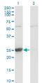 Thymidine Kinase 1 antibody, H00007083-M06, Novus Biologicals, Western Blot image 