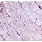 Wnt Family Member 10B antibody, MBS150774, MyBioSource, Immunohistochemistry paraffin image 