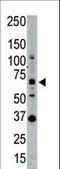 SUMO Specific Peptidase 1 antibody, LS-B3387, Lifespan Biosciences, Western Blot image 