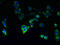 Cytochrome P450 Family 4 Subfamily F Member 11 antibody, LS-C372112, Lifespan Biosciences, Immunofluorescence image 