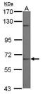 Zinc Finger Protein 334 antibody, GTX121366, GeneTex, Western Blot image 