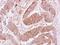 VPS35 Retromer Complex Component antibody, LS-C185941, Lifespan Biosciences, Immunohistochemistry paraffin image 