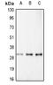 RAD52 Motif Containing 1 antibody, GTX55275, GeneTex, Western Blot image 