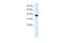 Transcription Factor AP-4 antibody, 27-866, ProSci, Western Blot image 