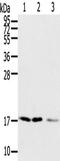 Sorting Nexin 3 antibody, TA351735, Origene, Western Blot image 