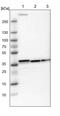 Galactosidase Alpha antibody, PA5-51364, Invitrogen Antibodies, Western Blot image 