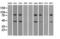 Small RNA Binding Exonuclease Protection Factor La antibody, GTX83560, GeneTex, Western Blot image 