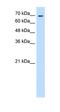 Transglutaminase 2 antibody, orb330510, Biorbyt, Western Blot image 